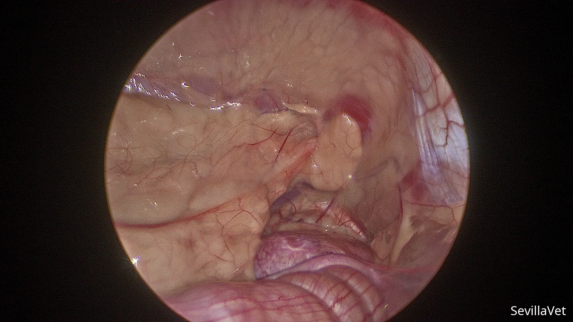 Laparoscopic view of the bladder and uterus during minimally invasive surgery