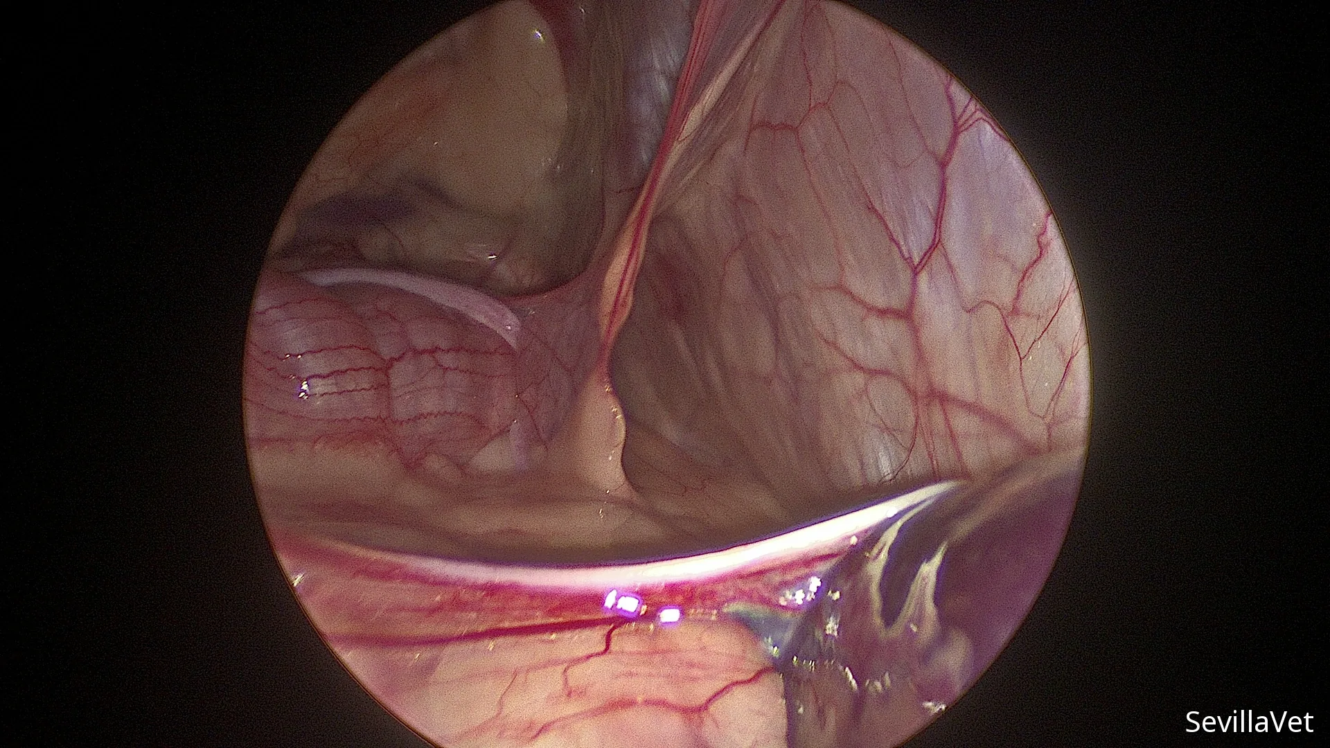 Laparoscopic view of the colon during abdominal exploration