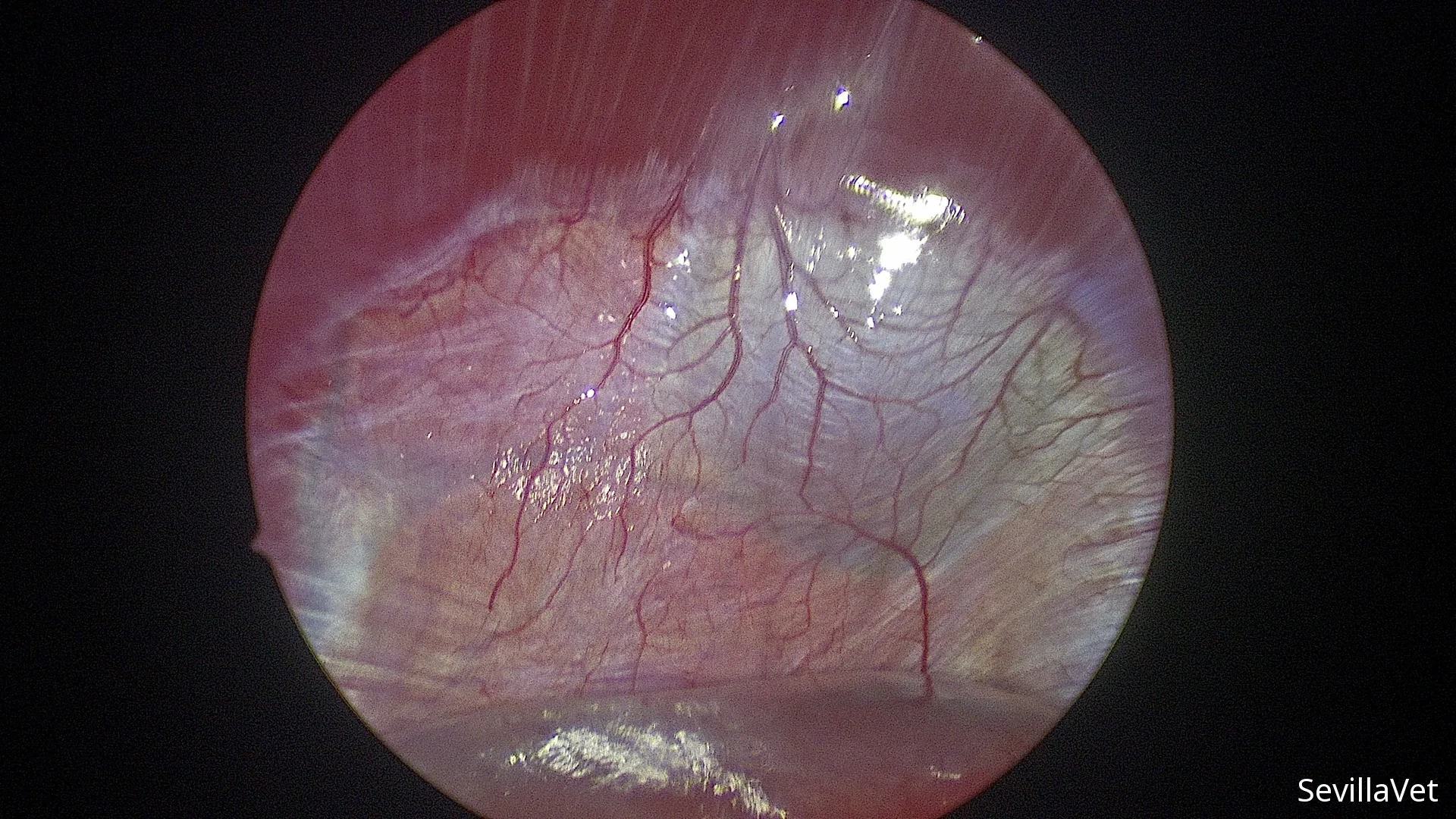 Laparoscopic view of the diaphragm during thoracic-abdominal exploration