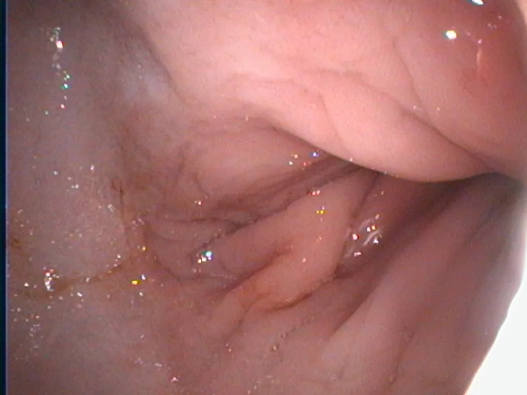 Endoscopic view of a canine stomach during gastroscopy