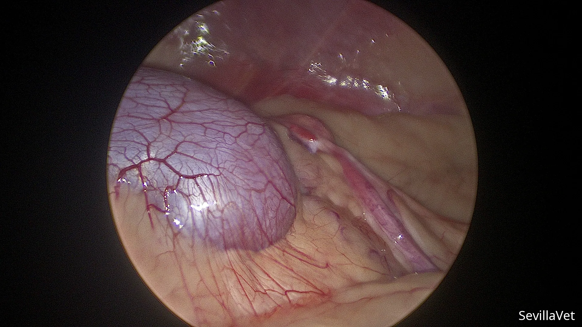 Laparoscopic view of the kidney and ovary during abdominal exploration