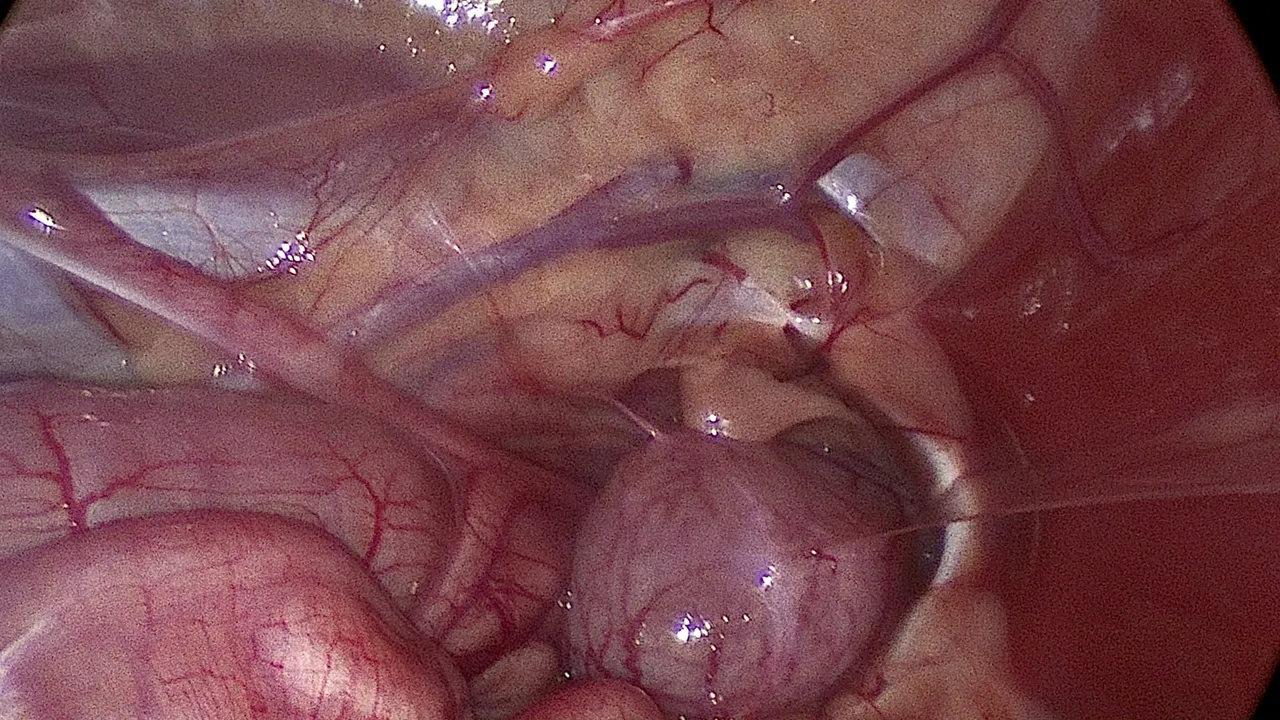 HD laparoscopic view of the uterus, ovary and bladder during a minimally invasive spay in Santa Monica