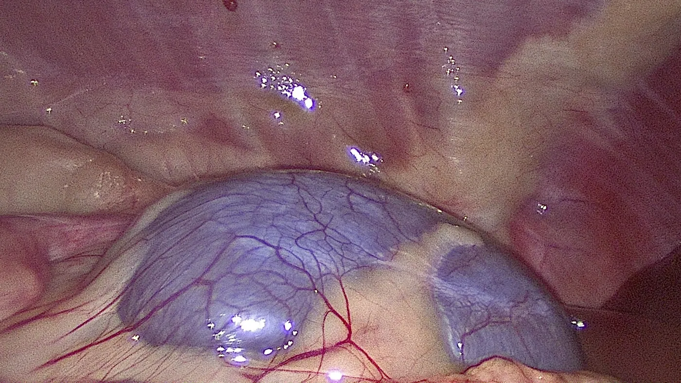 Close-up laparoscopic view of a canine kidney