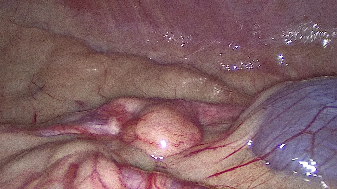 Laparoscopic view of a canine ovary during a keyhole spay