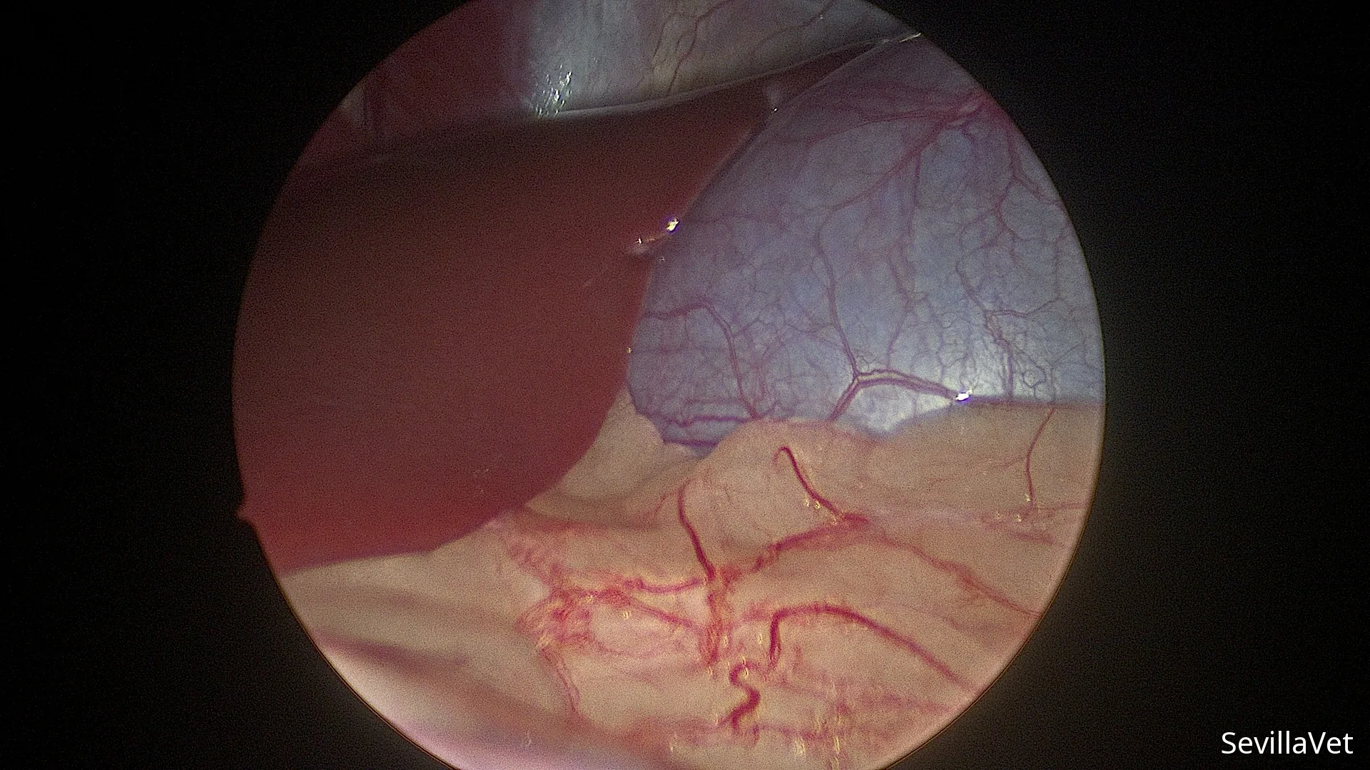 Laparoscopic view of the liver and gallbladder during a biopsy