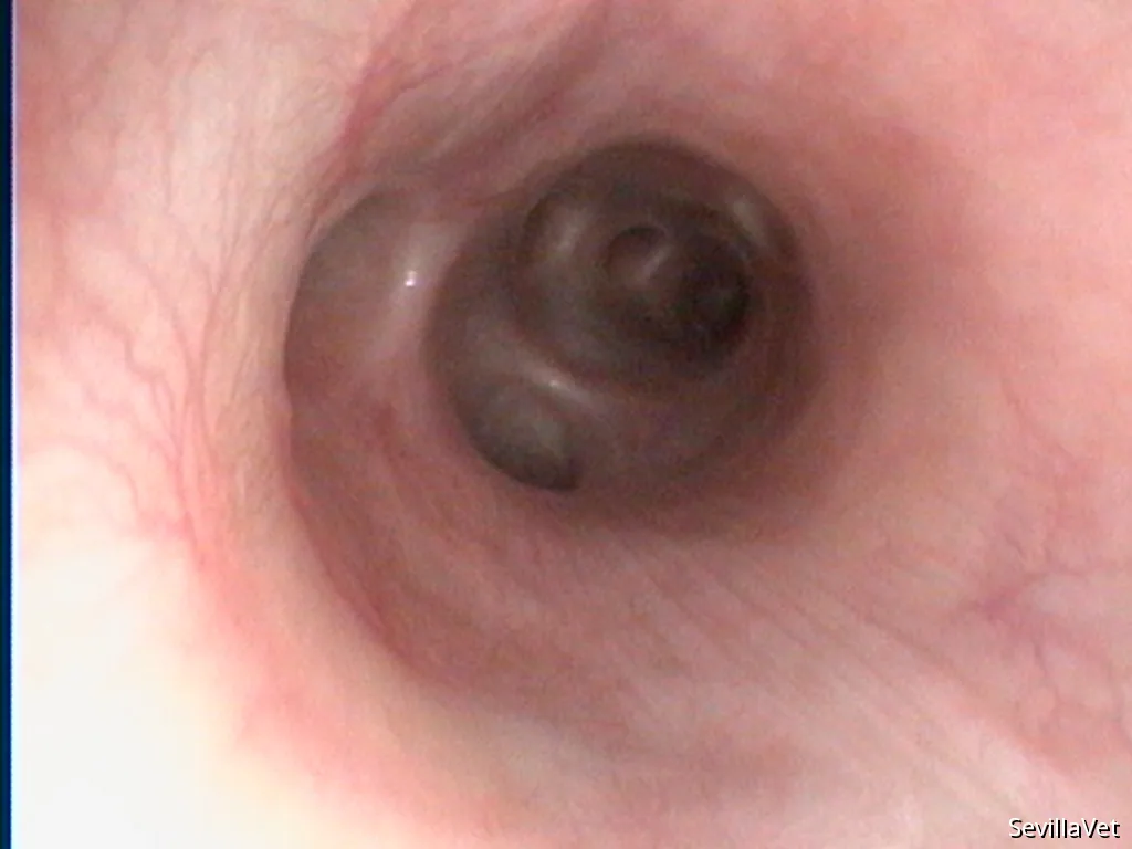 Thoracoscopic close-up of the right lung lobe