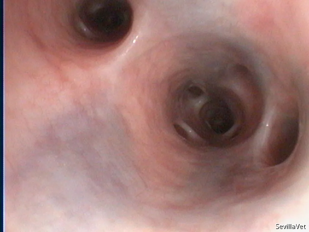 Thoracoscopic view of the right lung during chest exploration