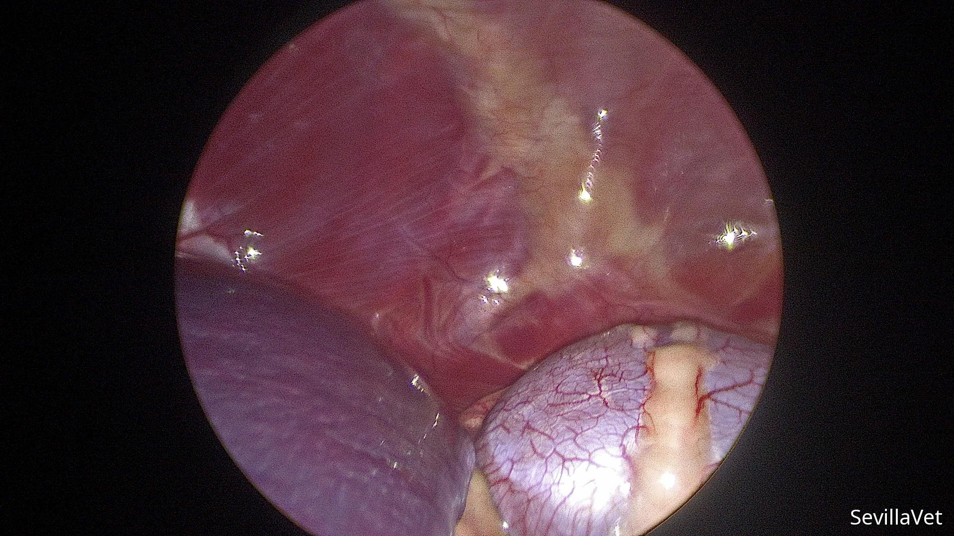 Laparoscopic view of the spleen and kidney during abdominal exploration
