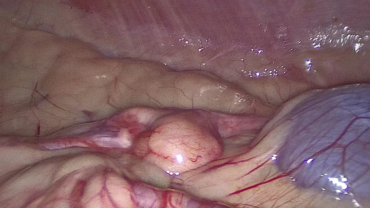 Close-up laparoscopic view of a healthy canine ovary before sealing during a keyhole spay